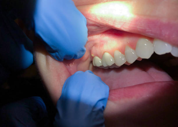 Best Emergency Root Canal Treatment in Kgsford Heights, IN