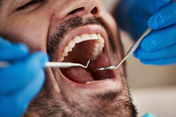 Best Pediatric Emergency Dentist in Kgsford Heights, IN
